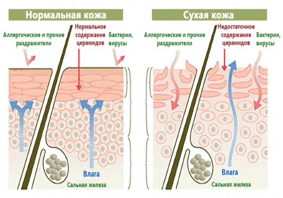 Сухая кожа