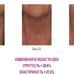 Сыворотка-биоревитализант 50+