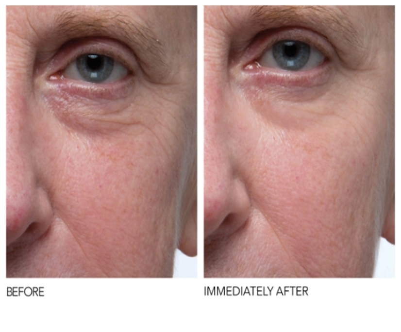 Сыворотка-биоревитализант 50+ — изображение 2