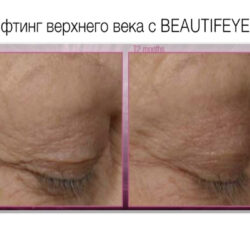 Сыворотка для области глаз